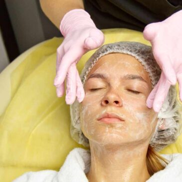 Exfoliante Químico