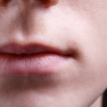 Eliminación de Micropigmentación